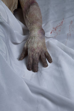 Water Logged Skin