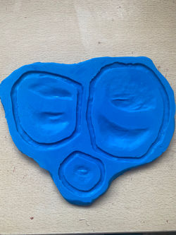 Swollen Eye Mould
