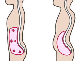 こんな悩みありませんか?実はそれ腹圧が原因かもしれません!!