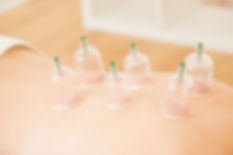 Cupping Therapy - Sen Health Clinic