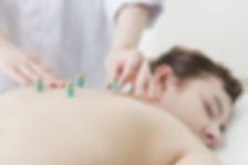 Acupuncture & Moxibustion - Sen Health Clinic