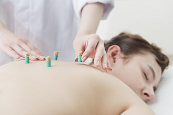 Acupuncture & Moxibustion - Sen Health Clinic