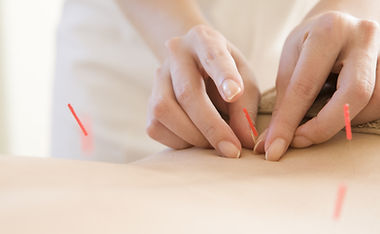 Acupuncture & Moxibustion - Sen Health Clinic