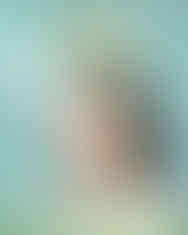 4단계 고주파 리프팅 플랜