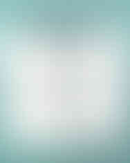 4단계 고주파 리프팅 플랜