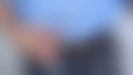 Exploring the Advancements and Advantages of Peritoneal Dialysis