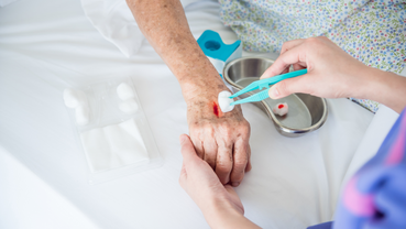 Comprehensive Guide to Effective Wound Management