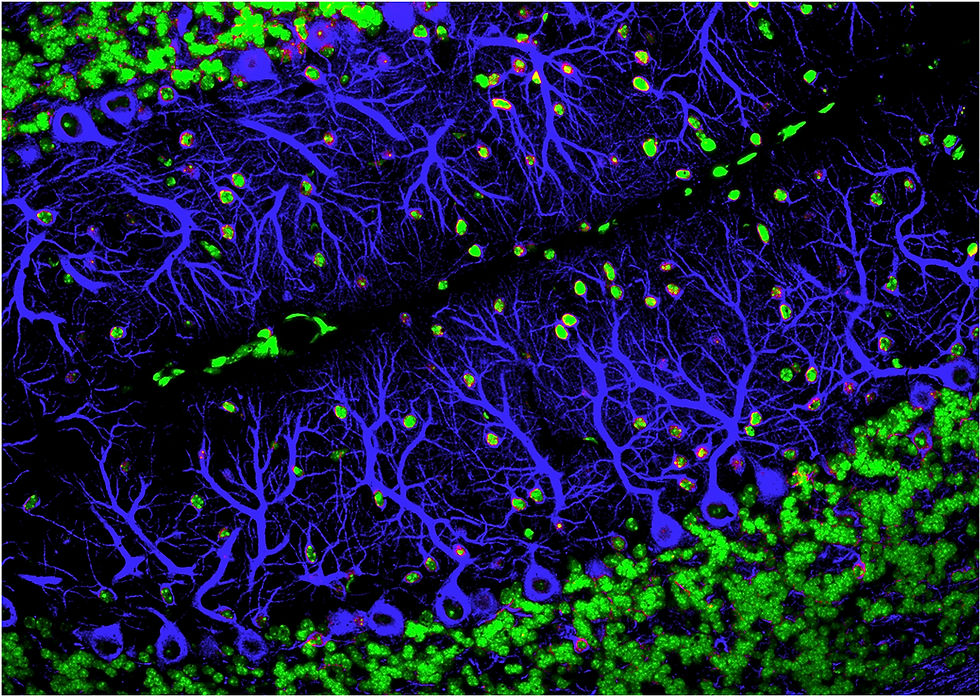 Sakai J: How synaptic pruning shapes neural wiring during development and, possibly, in disease. PNAS, 2020. https://doi.org/10.1073/pnas.2010281117
