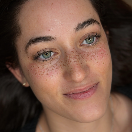 Medium Coverage Freckles_edited.png