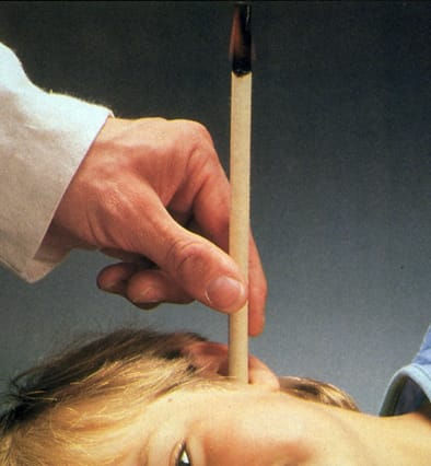 Otosan Cônes pour l'Hygiène de l'Oreille