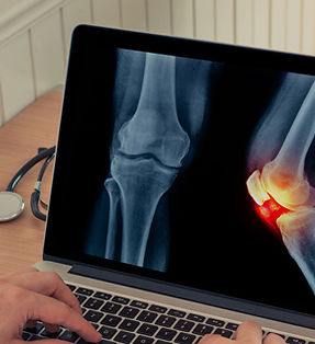 Dolor de Articulacion Rayos X