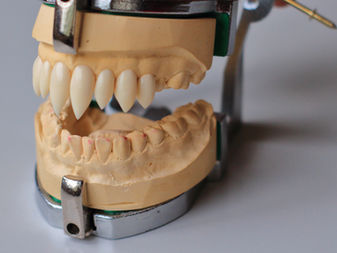 What Exactly Are These Fangs?