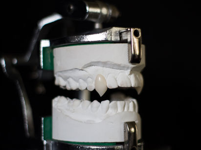How to Get Vampire Teeth to Stay On!