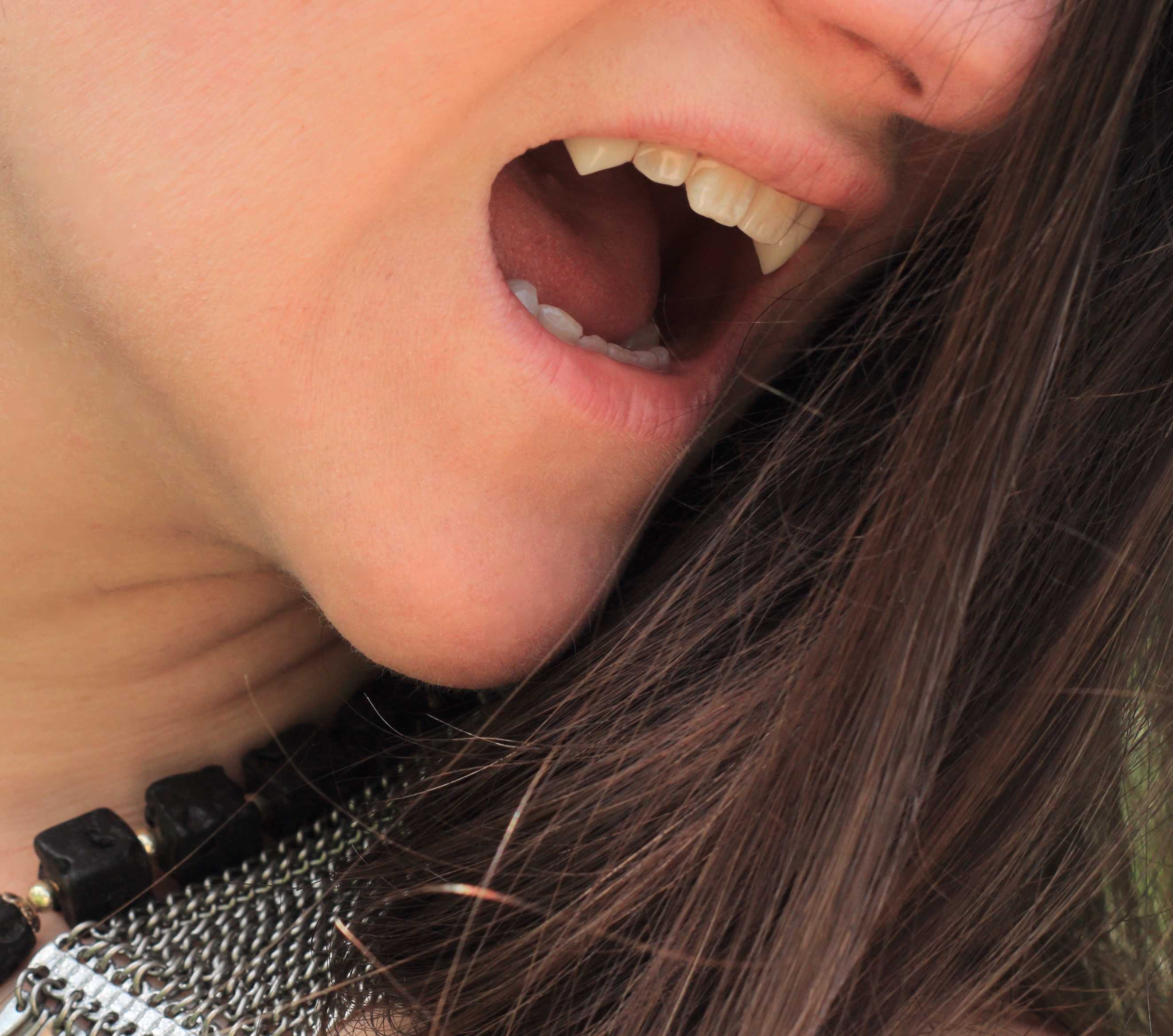 FangSmith Custom Vampire Fangs Fang Designs