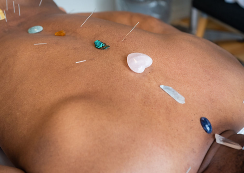 Source Healing acupuncture
