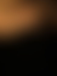 Tourist Shares Exclusive Account to ARC+ of Fire at Hotel Fantasy Island