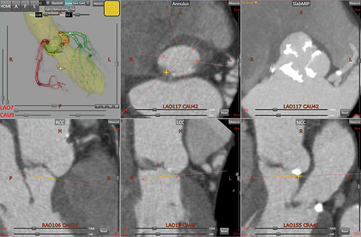 スクリーンショット 2026-03-23 0.20.08.png