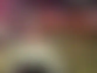 Acidente entre moto e carro deixa motociclista ferido entre Getúlio Vargas e Estação