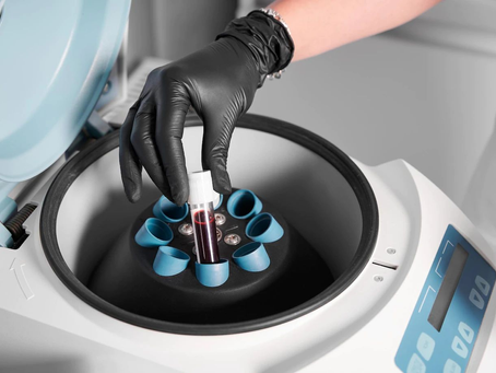 Inscrições para curso sobre hemocomponentes e ciclo do sangue na URI encerram nesta sexta-feira