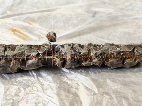 突然のみぞおちの痛みと向き合う