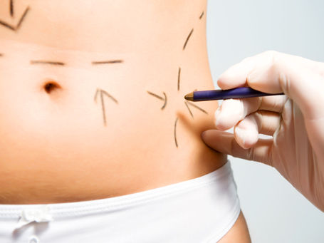 cirurgia plática