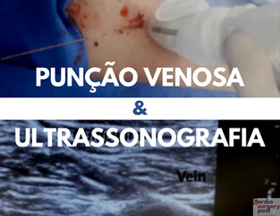 Punção venosa guiada por ultrassonografia: vantagens e características do procedimento