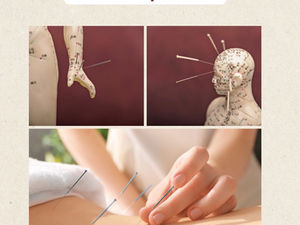 What is Acupuncture?