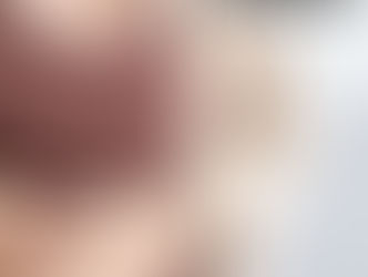 Will PCOS Go Away?