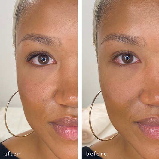 Yas before after.png