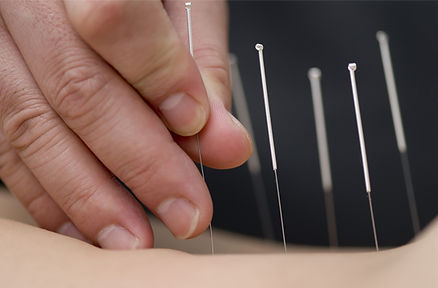 treatment-img acu.jpg