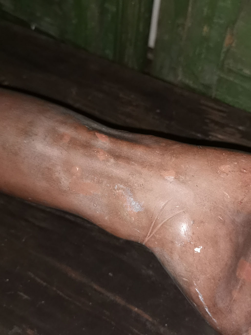 Thumbnail: ANATOMICAL MODEL ARM