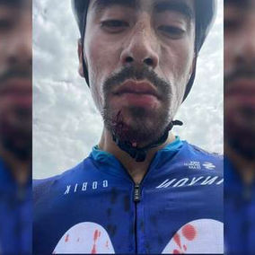 Ivan Rámiro Sosa fue atacado en plena vía de Cundianamarca