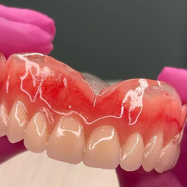 Prefeitura de São Gabriel da Palha entrega próteses dentárias gratuitas a mais de 90 pacientes em ação histórica de saúde bucal