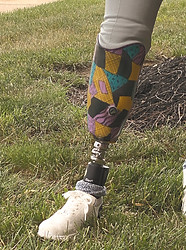 in-house custom prosthetic lamination_edited.jpg