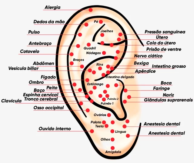 auriculoterapia