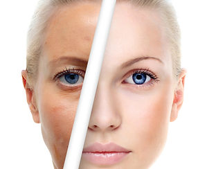 Limpeza de pele e estética em Santo Ângelo na DERLLIN