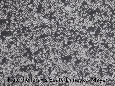 100fache Vergrößerung , schönes Blut.jpg