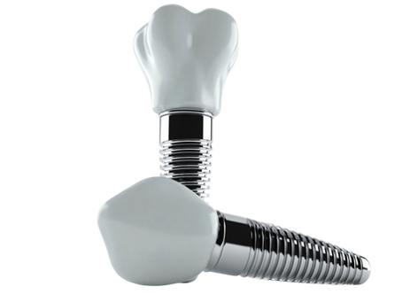 Dental Implants: The Natural Choice for a Confident Smile