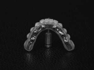 Cómo ha evolucionado el trabajo entre clínica y laboratorio dental