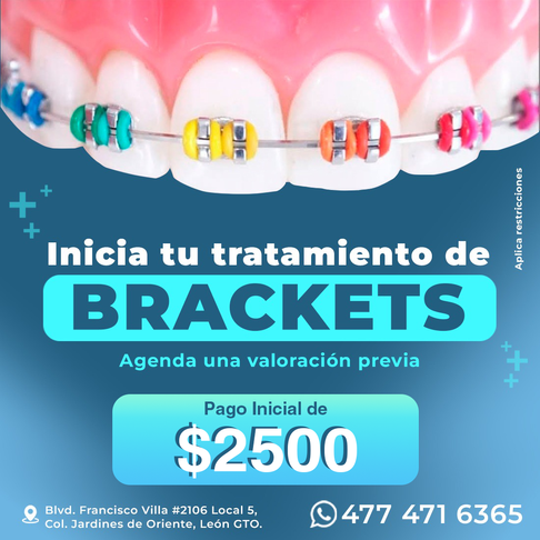 brackets