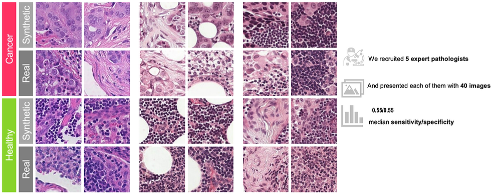 Figure displaying realistic-looking histopathology images generated using diffusion models.
