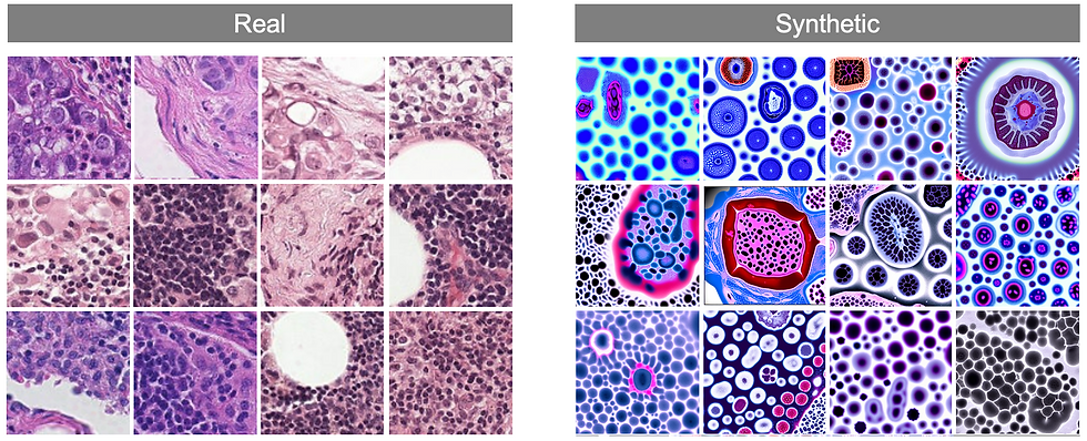 Figure displaying examples of artistic-looking histopathology images generated using an off-the-shelf generative diffusion model for medical imaging