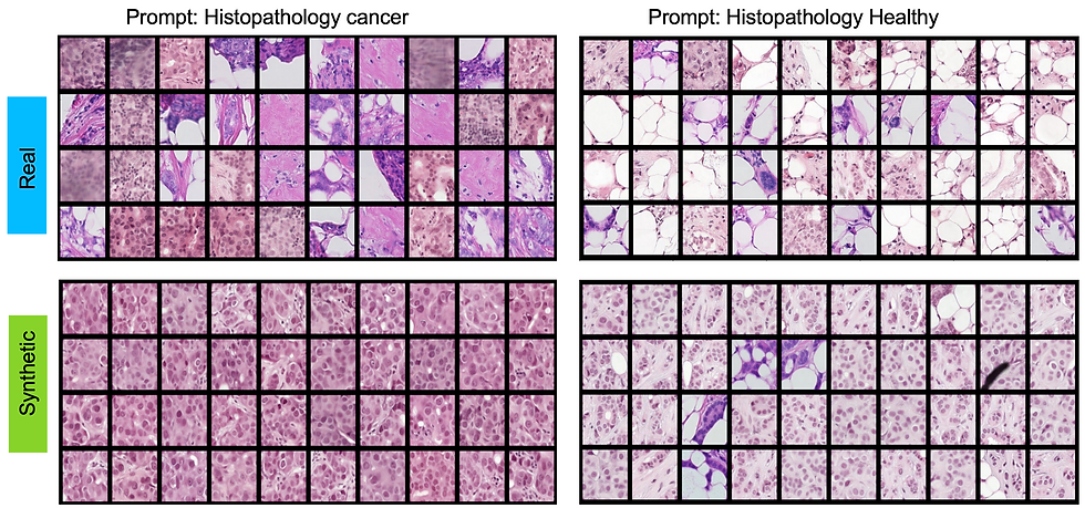 Figure illustrating an example of model collapse in generative AI applied to medical imaging, highlighting potential challenges in model training and output stability.