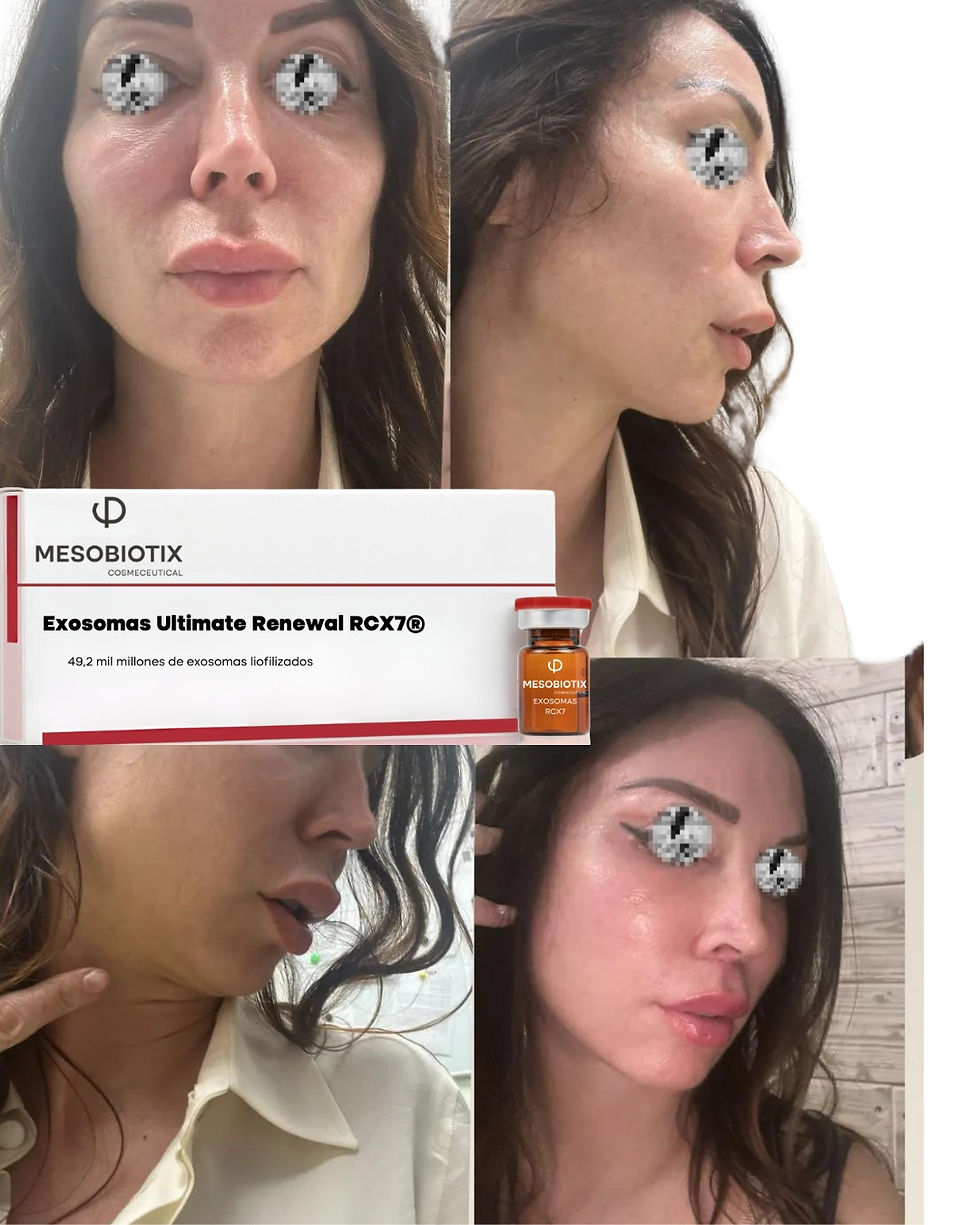 Miniatura: EXOSOMAS RCX7® ULTIMATE RENEWAL