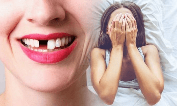 Nằm mơ thấy rụng răng hàm trên điềm báo gì? Đánh con gì chuẩn nhất? content media