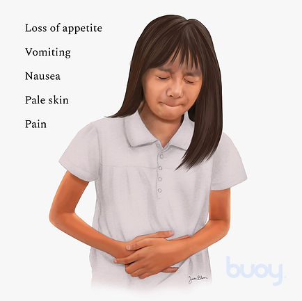 Abdominal Migraine Illustration