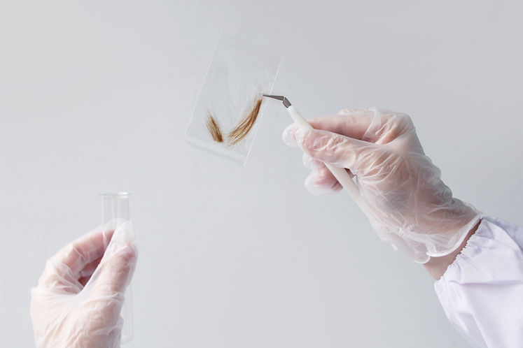 Hair mineral metal toxicity test