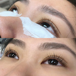 Before and After