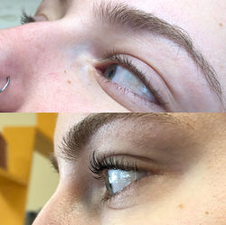 Before and After