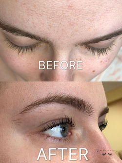 Before and After